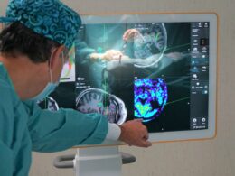Foto de Neurocirujano planificando con neuronavegador